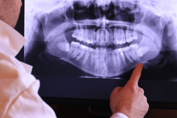 Best Emergency Treatment for Toothache in Paris, IL