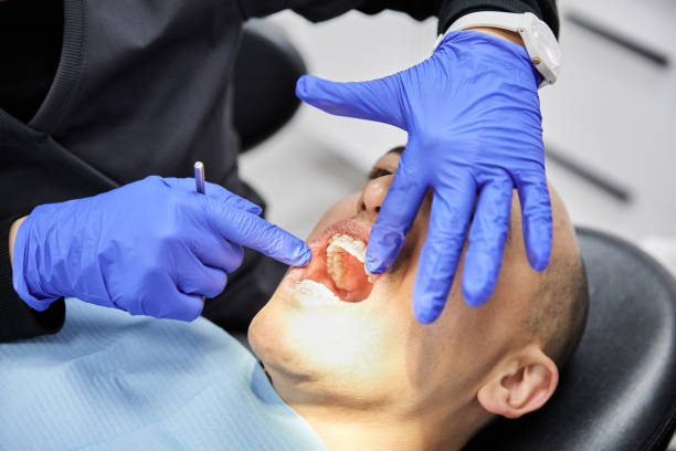 Best Emergency Dental Surgery in Paris, IL