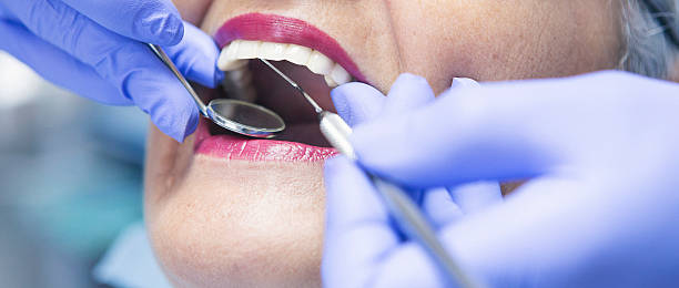 Best Walk-In Emergency Dentist in Paris, IL